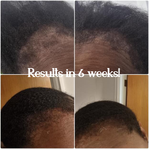 SCH RENAISSANCE HAIR GROWTH OIL